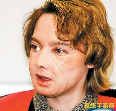 原神脸上有伟字的丘丘人