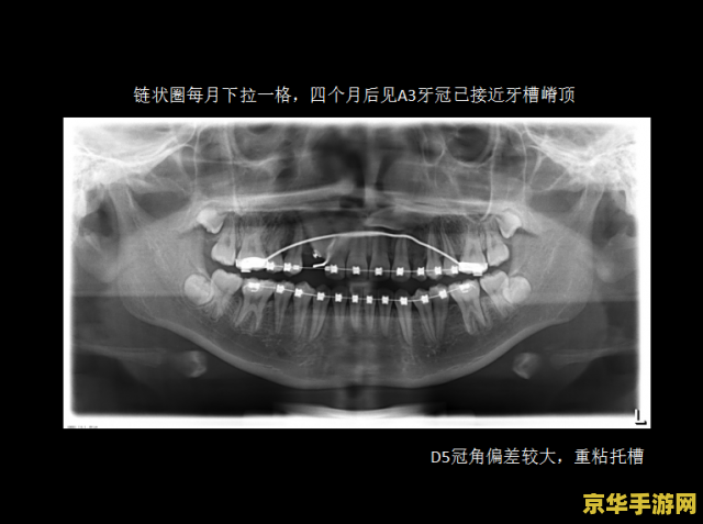 原神寻找三个奇异的牙齿