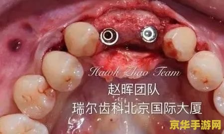 原神三颗奇异的牙齿护罩攻略